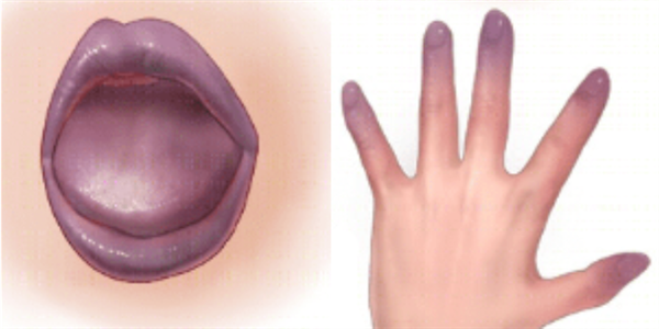 以为能吃其实可能有毒的7种食物！快转发到“相亲相爱一家人”