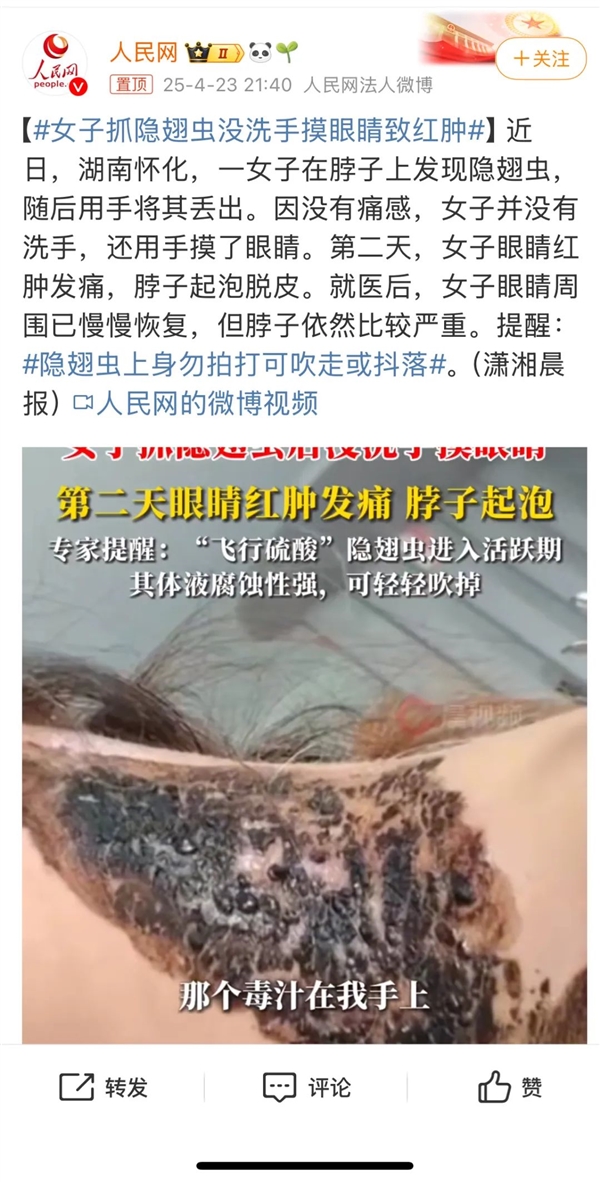 有人因此“毁容”!近期这种虫子很活跃 遇到千万不能拍